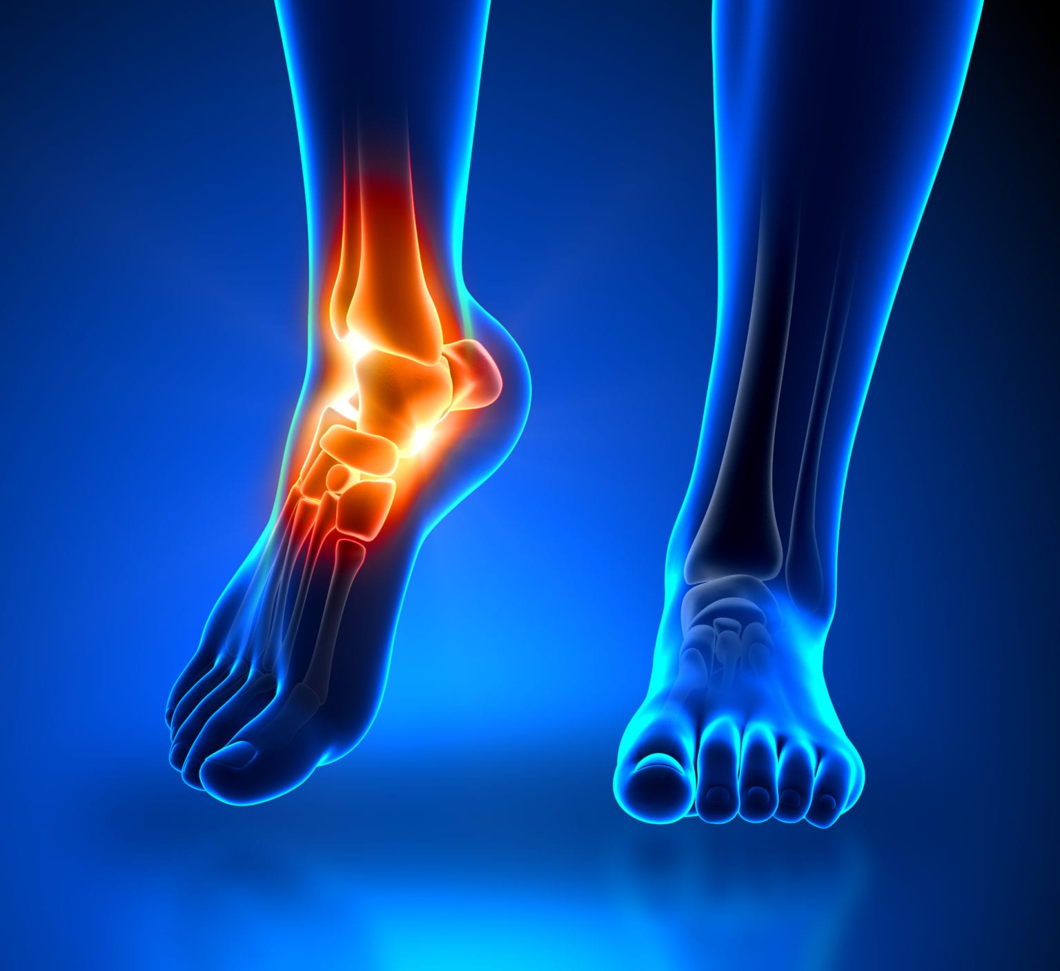 ankle surgery for arthritis
